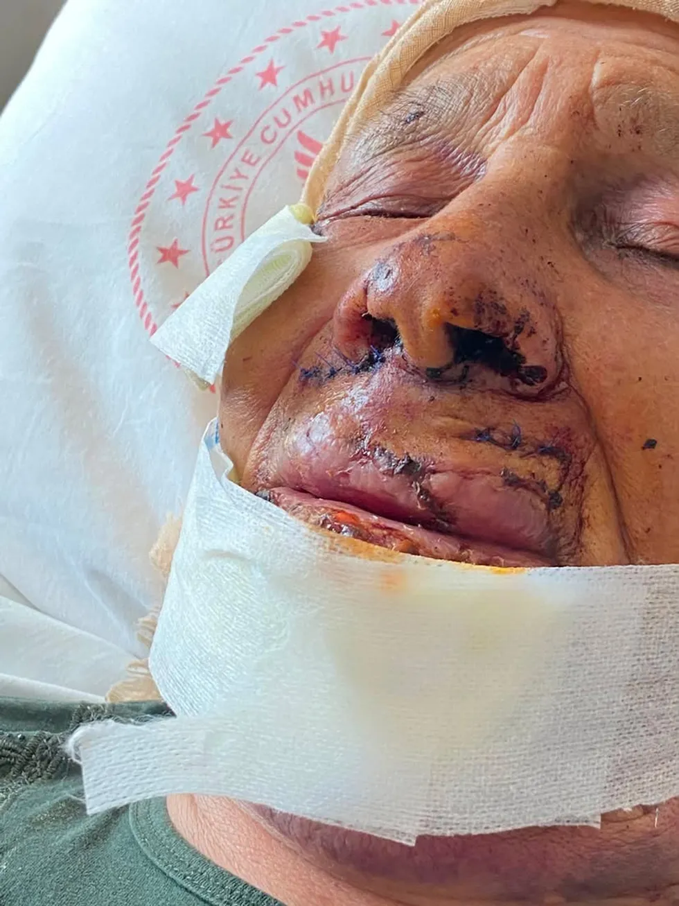 Evlat demeye bin şahit gerek! 85 yaşındaki annesini sopayla dövdü: İşte dehşete düşüren o anlar - 2