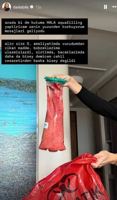 5-kez-ameliyat-olan-danla-bilic-bobregime-ulasmislardi-1765264162464.jpg Kaynak: Instagram