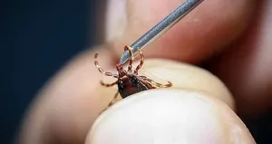 O ilde kene kabusu! 1 haftada 255 vaka