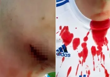Futbol terörü! Boğazını bıçakla kesti!