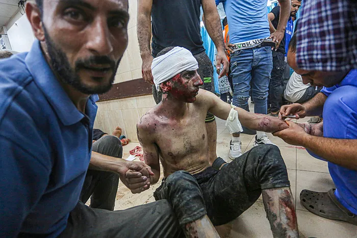 1723117060203.jpg Türkiye'nin İsrail'e karşı hamlesi dünya basınında: Türklerin hamlesi davayı daha da güçlendirdi... - 2
