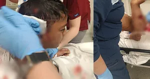 Küçük çocuğa saldırdılar hastanelik oldu!