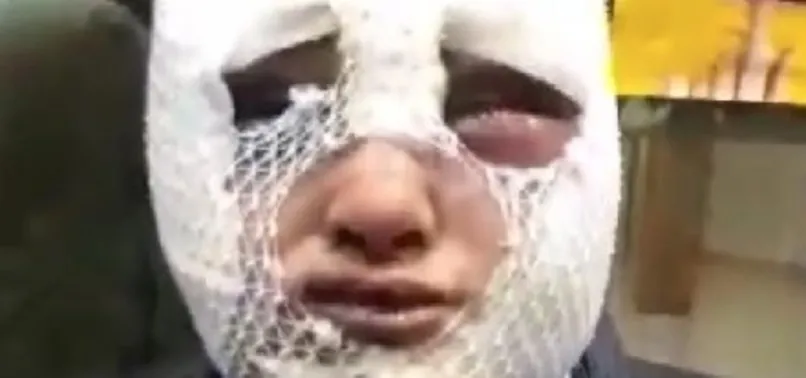 Eski sözlüsünü darp etti, tecavüz etti, başından aşağı kızgın yağ döktü: Serbest bırakıldı