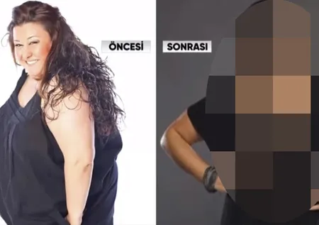 Ünlü oyuncunun son hali şoke etti! Arkadaşları bile tanıyamıyor... İşin sırrını anlattı: Benden bir ben daha çıktı