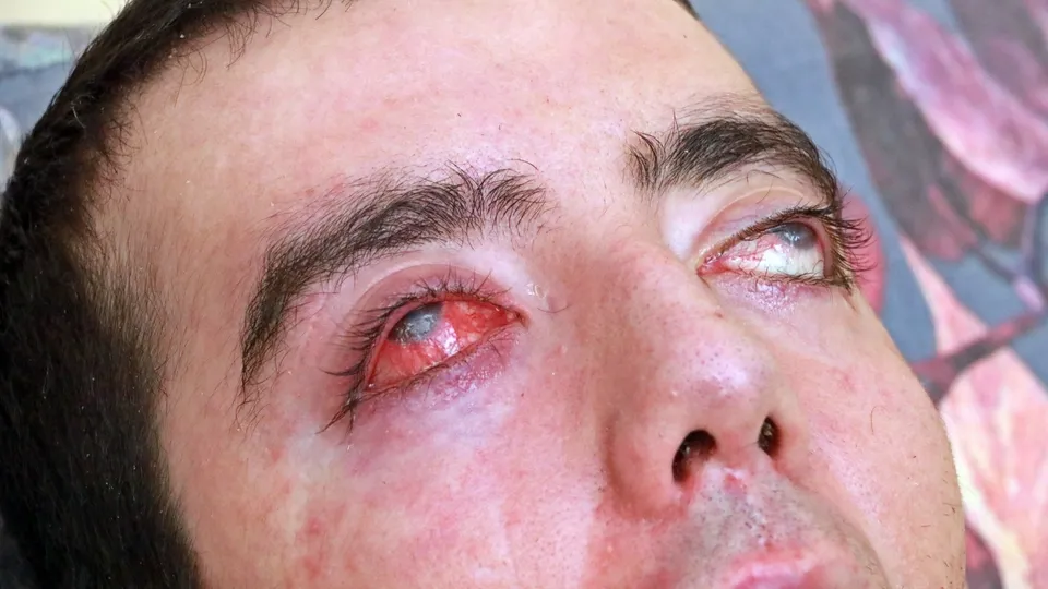 8 yıldır gözlerini kapatamıyor! Sadece ‘anne’ diyebiliyor