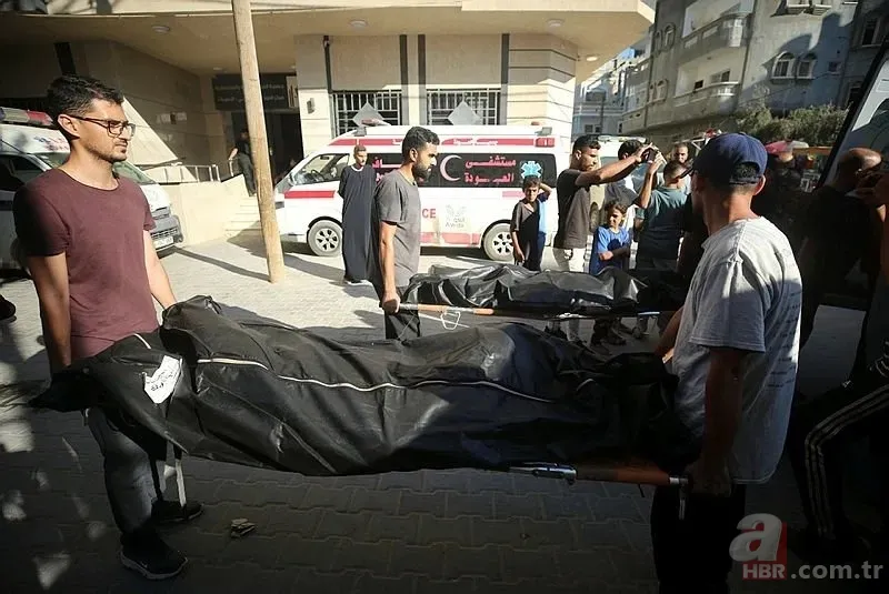 ABD'li doktor soykırımcı İsrail'in acımasızlığını herkese duyurdu: Karnından ve göğsünden vurulmuş çocuklar gördüm 17