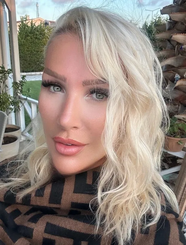 seda-sayanin-yuzune-ne-oldu-unlu-sanatci-acik-acik-soyledi-1767788558150.jpg Kaynak: Instagram