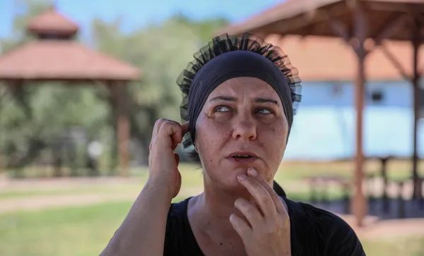 "Delirten Hastalık" hayatını kabusa çevirdi: Yüzümü koparıp atmak istiyorum - 1