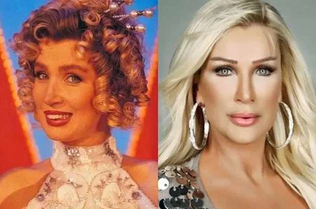 Zeynep Kocak In Son Hali Soke Etti Boyle Degisim Gorulmedi