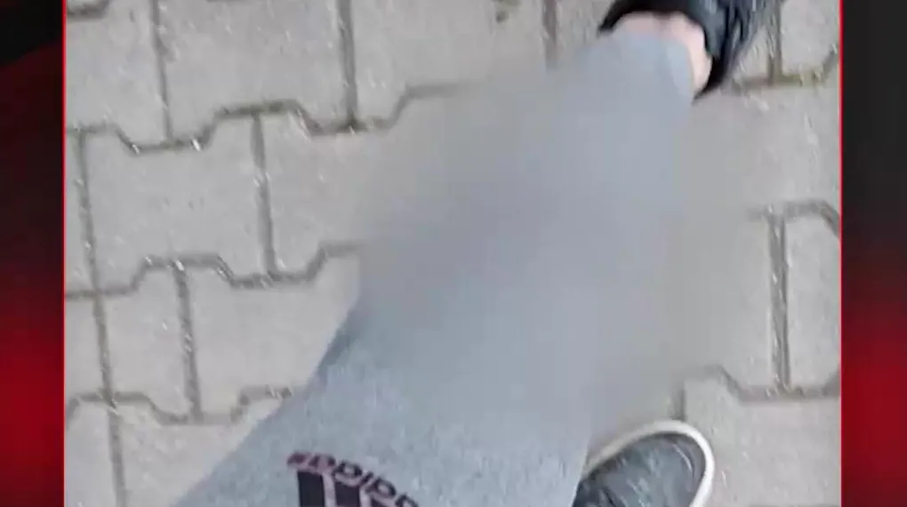 BAŞIBOŞ PİTBULL DEHŞET SAÇTI