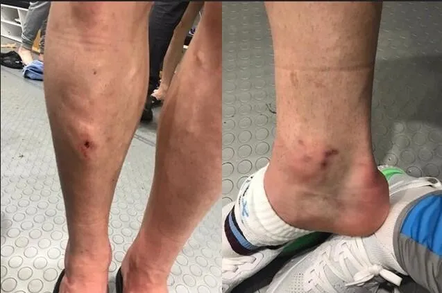 Spor hukukçusu Köse: Sörloth'un cezası iner - 2
