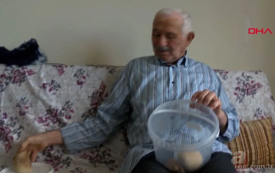 Karın bölgesinde şişlik ve halsizlik şikayetiyle doktora gitti! Karnından çıkanlar şoke etti 25