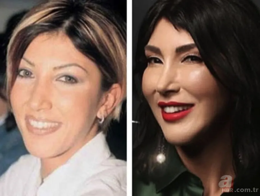 Mehmet Ali Erbil de estetik yaptırdı: Seda Sayan'a benzemeye geldim 13