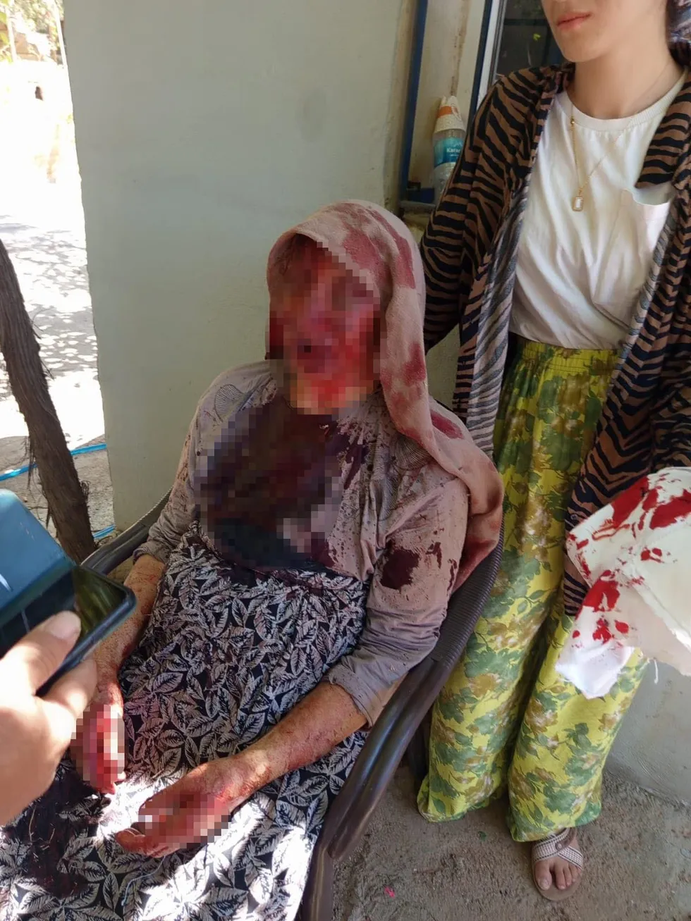 Evlat demeye bin şahit gerek! 85 yaşındaki annesini sopayla dövdü: İşte dehşete düşüren o anlar - 1