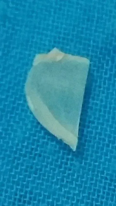 Vatandaşın sağlığıyla oynanıyor! Ankara Halk Ekmek’te bir skandal daha: Bakteriden sonra şimdi de...