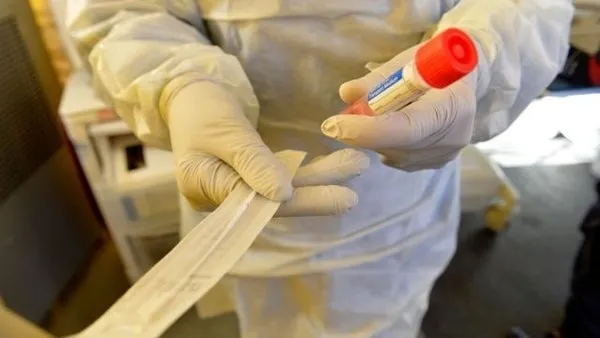 Türkiye'de kaç doz koronavirüs aşısı vuruldu? Türkiye en çok aşı yapılan ülkeler arasında - 11