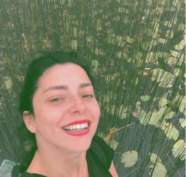 Merve Boluğur’dan bomba gibi estetik itirafı! ‘Gereksiz olduğunu düşünüyorum’