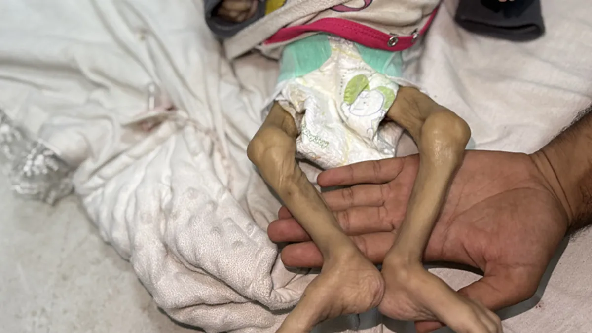 Başkan Erdoğan'dan BM'de tarihi Gazze manifestosu! Vahşeti fotoğraflarla haykırdı | İşte o karelerin hikayesi...