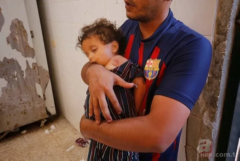 ABD'li doktor soykırımcı İsrail'in acımasızlığını herkese duyurdu: Karnından ve göğsünden vurulmuş çocuklar gördüm 16