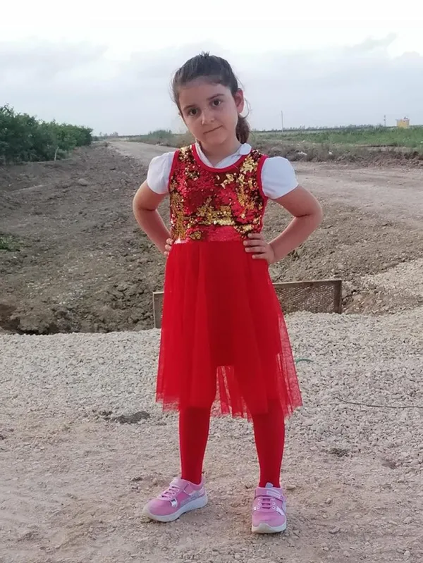 Adana'da korkunç olay! 7 yaşındaki küçük Zehra'nın ilaç makinesine kaptırdığı bacağı koptu - 3
