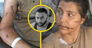 Karısını 104 yerinden bıçakladı