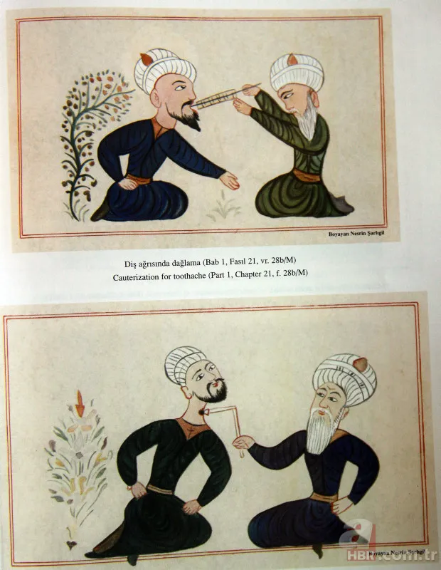 Hekimbaşı öyle bir şey yaptı ki… Osmanlı Padişahı bir anda can verdi: Cesedini mumyaladılar! 3