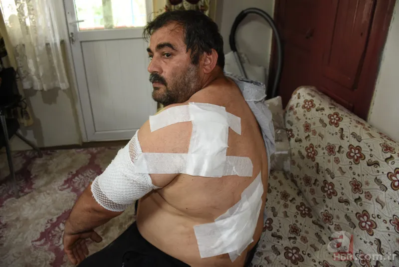 Bartın'da ayı saldırısı! 65 dikiş atıldı: Öldüğümü sanıp bıraktı 2