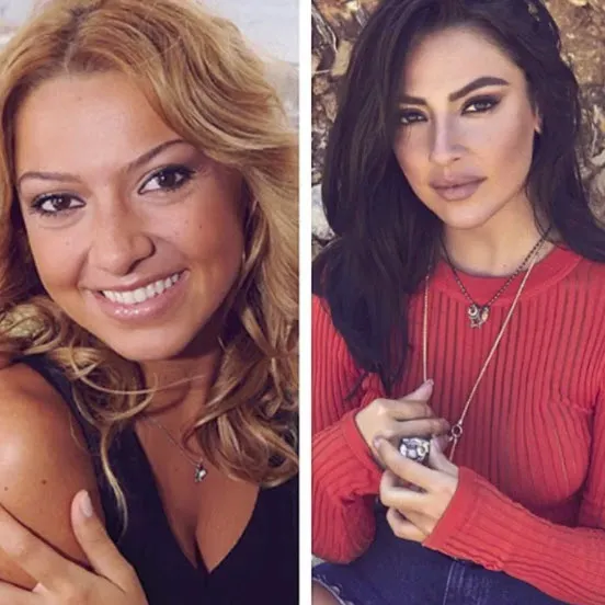 Kendall Jenner Eski Hali