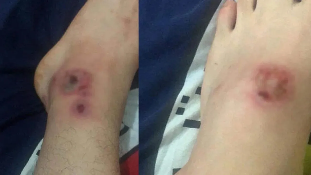 Sapanca Da Asya Kaplan I Cinsi Sivrisinekler Tatilcileri Canindan Bezdirdi