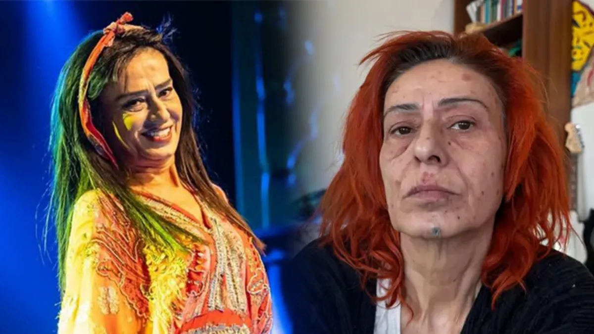 Yıldız Tilbe saçlarını kısacık kestirdi! "Yaralarım geçmeyecekti"