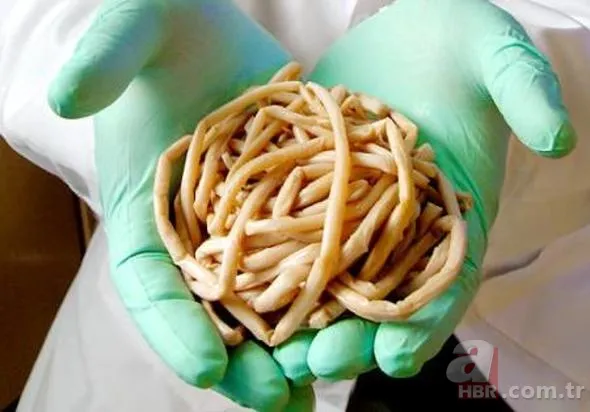 Uğur böceğinin mucizesi meğer kanatlarındaymış! 45