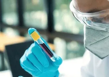 Antikor testi 7 pilot ilde başlayacak