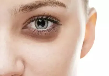 Gözaltı morlukları dert olmaktan çıkacak! 1 ay boyunca...