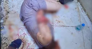 Korkunç olay! Arkadaşları kanlar içinde buldu