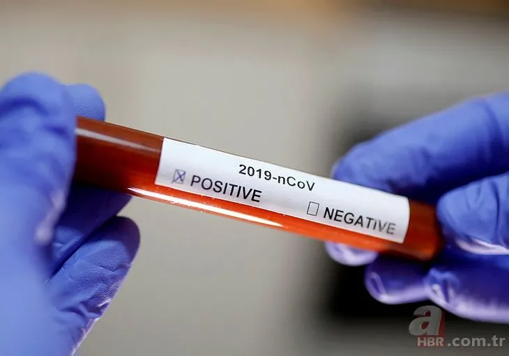 Çin’den dünyayı umutlandıran koronavirüs corona virüs Kovid-19 açıklama: Aşıyı bulduk