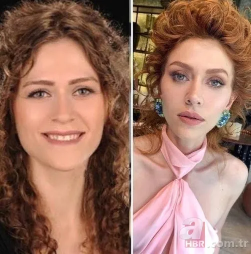 Bir Zamanlar Çukurova’nın Gülten’i Selin Genç de estetik harikası çıktı! Eski hali şoke etti 11