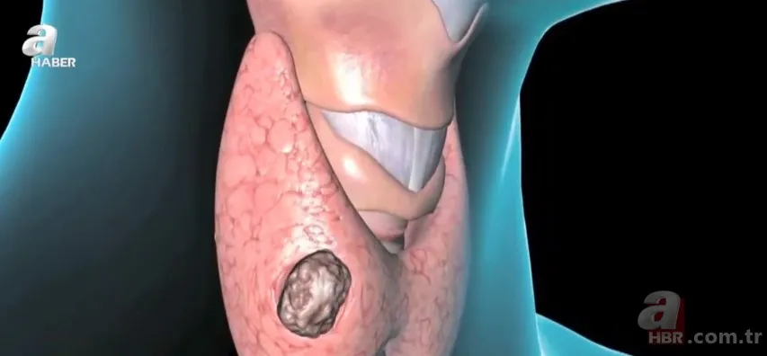 Gençler dikkat! Kablosuz kulaklıklar tehlike saçıyor 9