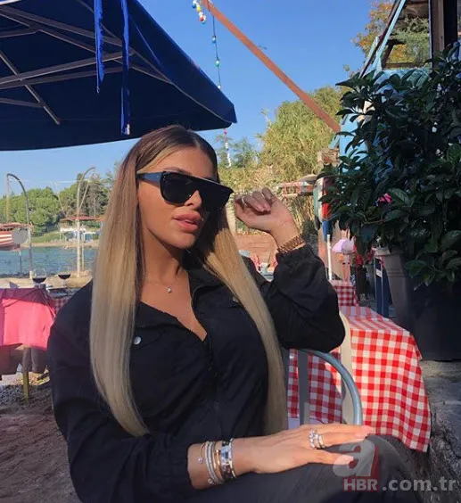 Adanalı dizisinin güzel oyuncusu Tuğçe Özbudak yeni haliyle olay oldu! Estetik yaptırmaktan öyle bir hale geldi ki... 6