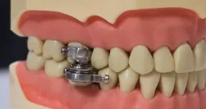 Kilo vermek isteyenler dikkat! İlk kez duyacaksınız