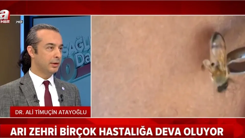 Apiterapi nedir? Arı zehri hangi hastalıklara iyi geliyor? Sağlıkta 10dakika | A Haber 04.05.2019