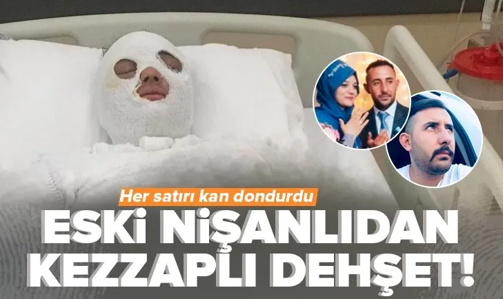 Eski nişanlıdan Merve Küçüktekin’e kezzaplı dehşet! Her detayı kan dondurdu