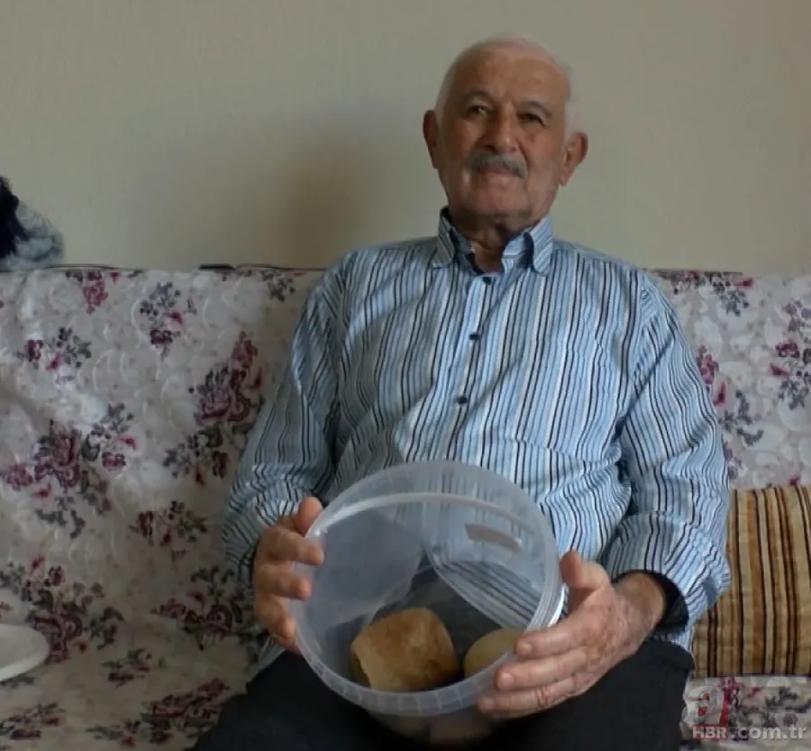 Karın bölgesinde şişlik ve halsizlik şikayetiyle doktora gitti! Karnından çıkanlar şoke etti 11