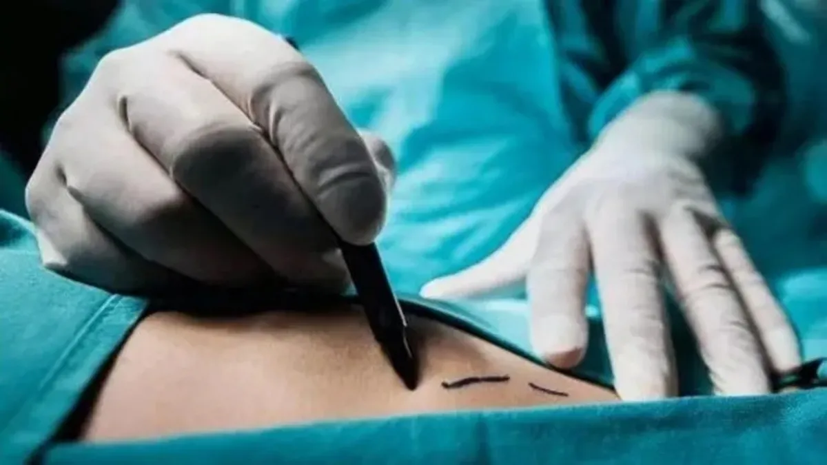 Yağ aldırmak isterken hayatı kabusa döndü! 4 ayda 9 ameliyat oldu: Vücudu bu hale geldi