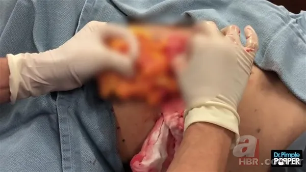 30 yıl boyunca baş ağrısıyla yaşadı! Nedeni şoke etti... 130