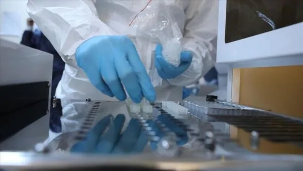 Sağlık Bakanlığı'ndan flaş koronavirüs hamlesi! Koronavirüs test kitleri... - 4