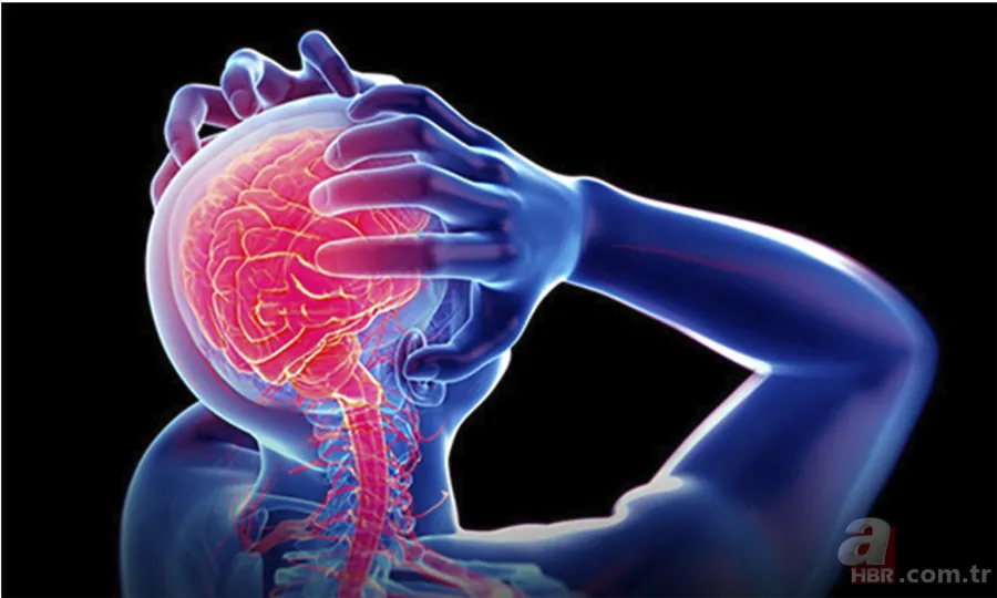 Migren sadece baş ağrısı değil: Beyindeki gerçek neden bulundu 7