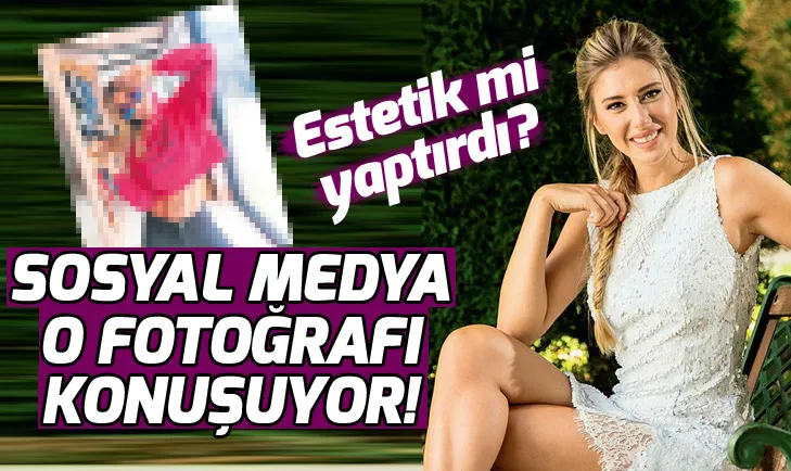 Şeyma Subaşı estetik mi yaptırdı?