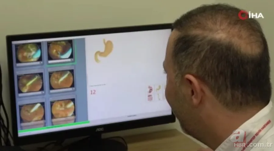 İnanılmaz! Doktorları bile hayrete düşürdü: 66 yıldır iç organları tersine çalışıyor 9