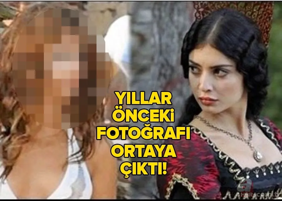 Bir Zamanlar Çukurova’nın Müjgan�ı Melike İpek Yalova estetiksiz