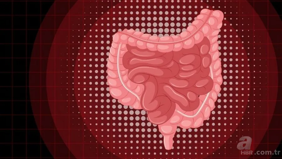 Kolon kanserine karşı etkili kalkan! Harvard doktorları öneriyor: 1 porsiyon yetiyor 5